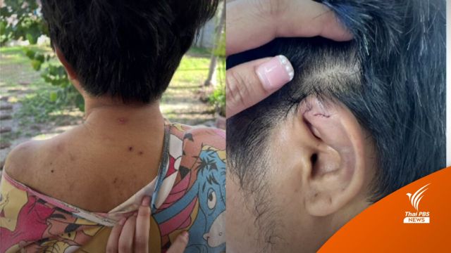 "ทหารหญิง" แจ้งความอ้างนายจ้างภรรยา ส.ว.ทำร้ายร่างกาย