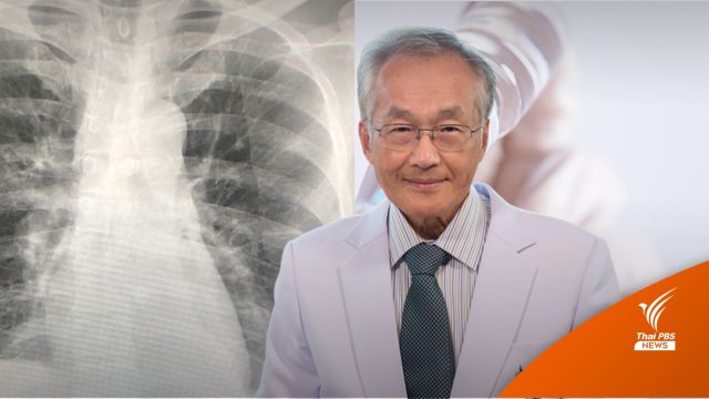 แนะฉีดวัคซีนป้องกันโควิด-ไข้หวัดใหญ่ ลดป่วยหนักหากติดเชื้อพร้อมกัน