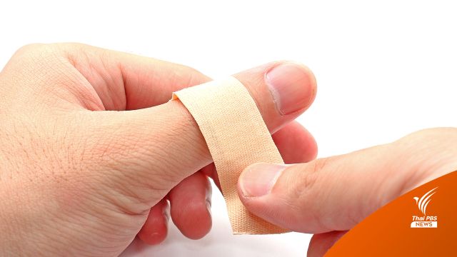 พลาสเตอร์ปิดแผล Microneedle Patch นวัตกรรมช่วยให้เลือดหยุดไหลเร็วขึ้น