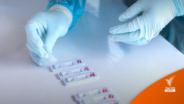 หมอเตือนยังต้องระวังเข้ม โควิด-19 ระบาดซ้ำ เพิ่มวันละกว่า 20,000 คน