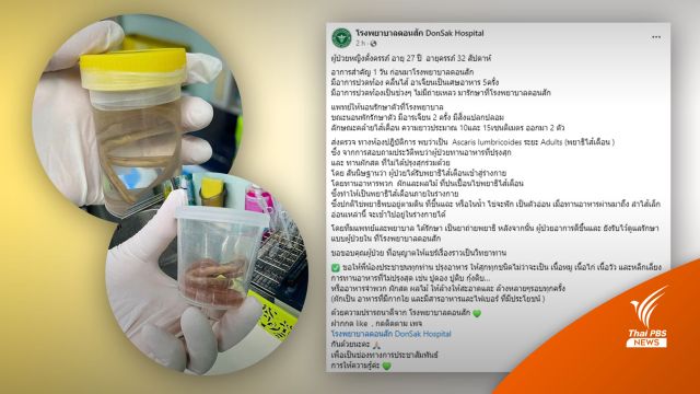 รพ.โพสต์เตือน สาวท้องกินผักสด เจอ "พยาธิไส้เดือน" ยาวครึ่งฟุต!