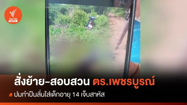 สั่งย้าย-ตั้งกรรมการสอบ "ตำรวจ" ปมทำปืนลั่นใส่เด็กอายุ 14 ปี