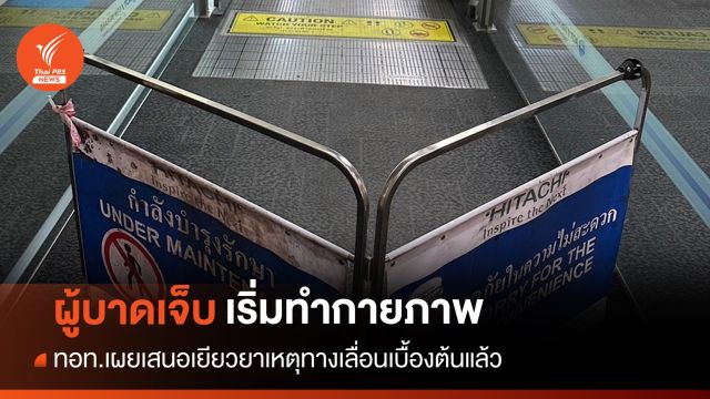 ผู้บาดเจ็บเหตุทางเลื่อนสนามบินดอนเมืองเริ่มทำกายภาพ
