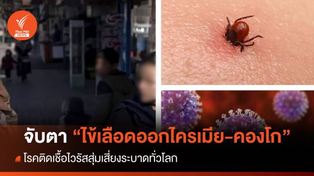 WHO จับตา "ไข้เลือดออกไครเมีย-คองโก" สุ่มเสี่ยงระบาดทั่วโลก