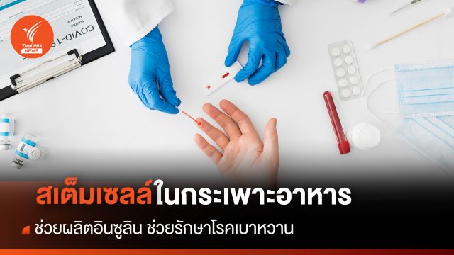 วิจัยพบสเต็มเซลล์ในกระเพาะอาหาร ช่วยผลิตอินซูลิน ช่วยรักษาโรคเบาหวาน