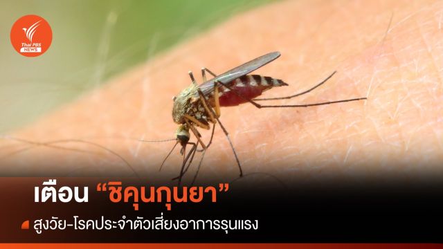  "สูงวัย" เสี่ยงป่วย "ชิคุนกุนยา" รุนแรง ไข้เลือดออกพุ่ง 2,633 คน  