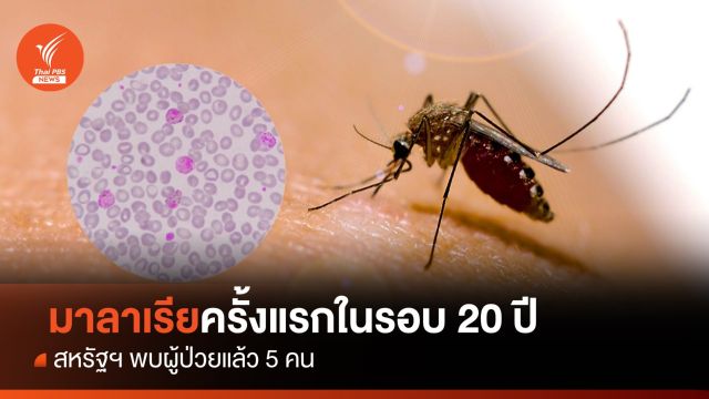สหรัฐฯ พบผู้ป่วยมาลาเรียครั้งแรกในรอบ 20 ปี
