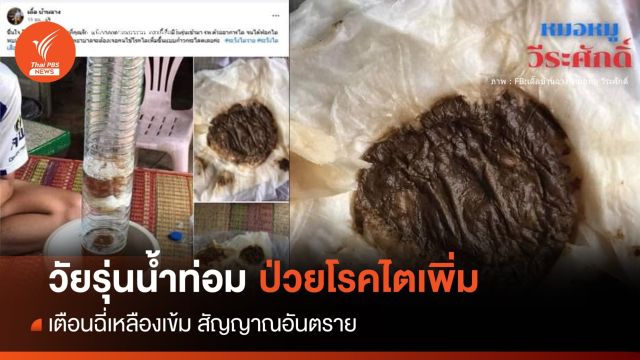  เตือน! วัยรุ่นน้ำท่อม ป่วยโรคไตพุ่ง-ชี้ฉี่เหลืองเข้มพบหมอด่วน