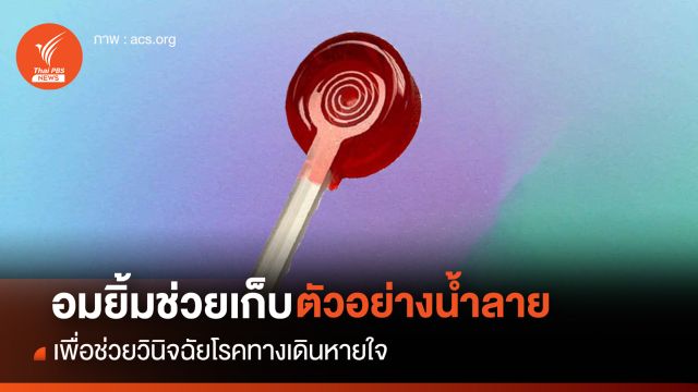 "อมยิ้ม" เก็บตัวอย่างน้ำลาย ช่วยวินิจฉัยโรคทางเดินหายใจ แทนวิธีกวาดคอ