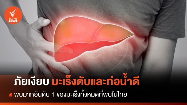 ภัยเงียบต้องระวัง “มะเร็งตับและท่อน้ำดี” ระยะแรกมักไม่แสดงอาการ