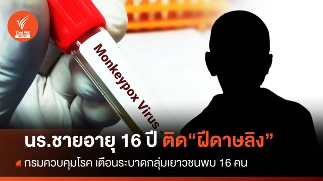 น่าห่วง! "ฝีดาษลิง" ส.ค.นี้เพิ่มอีก 145 คนต่ำสุดชายอายุ 16 ปี