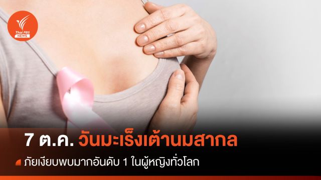7 ต.ค."วันมะเร็งเต้านมสากล" เช็กเต้านมเองง่ายๆ-ตรวจคัดกรองฟรีก็มี