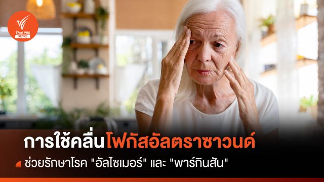 การใช้คลื่นโฟกัสอัลตราซาวนด์ อาจช่วยรักษาโรค "อัลไซเมอร์" และ "พาร์กินสัน" ได้