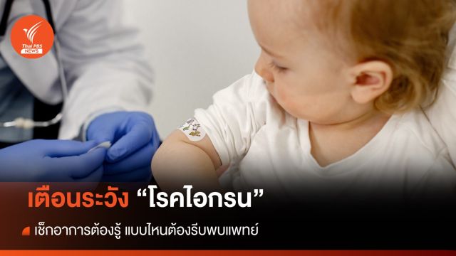 เช็กอาการที่บ่งบอก "โรคไอกรน" ในเด็ก ปี 66 พบป่วยแล้ว 13 คน