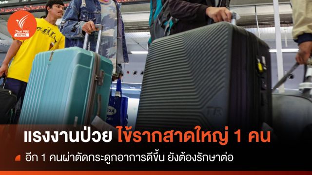 สธ.พบแรงงานป่วยไข้รากสาดใหญ่ 1 คน ผ่าตัดกระดูกอาการดีขึ้น