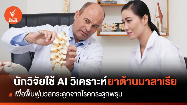 นักวิจัยใช้ AI วิเคราะห์ยาต้านมาลาเรีย พัฒนายาฟื้นฟูมวลกระดูกจากโรคกระดูกพรุน