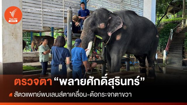 หมอตรวจตา "พลายศักดิ์สุรินทร์" เลนส์ตาเคลื่อน-ต้อกระจกตาขวา