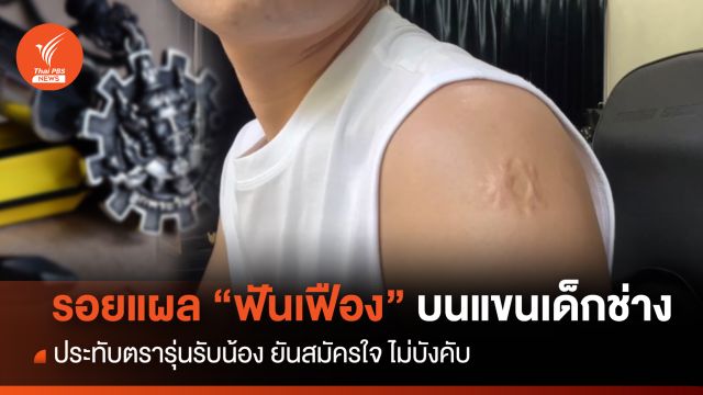 รอยแผล "ฟันเฟือง" บนแขนนักเรียนช่าง ประทับตรารุ่นรับน้อง 