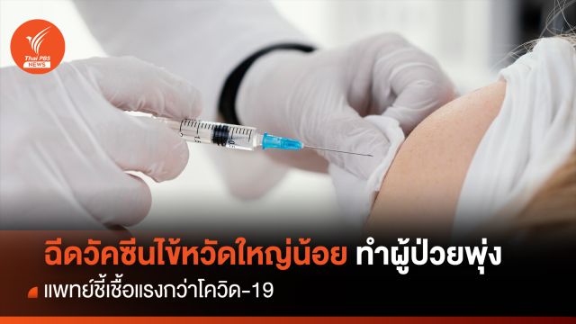 รับวัคซีนไข้หวัดใหญ่น้อย ทำผู้ป่วยพุ่ง 