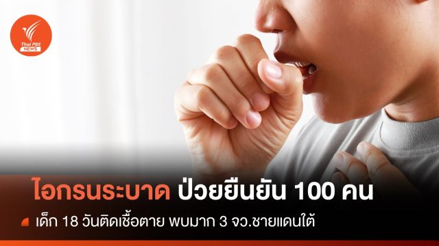 เตือน "ไอกรน" พบระบาด 3 จว.ชายแดนใต้-เด็ก 18 วันเสียชีวิต