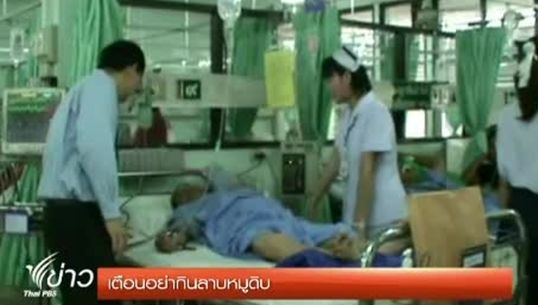 "โรงพยาบาลน่าน"เตือนปชช. ห้ามกิน"ลาบหมูดิบ"