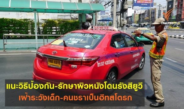 แพทย์แนะวิธีป้องกัน-รักษาผิวหนังโดนรังสียูวี-เฝ้าระวังเด็ก-คนชราเป็นฮีทสโตรก