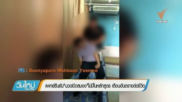 แพทย์เตือน"นวดเปิดสมอง"เสี่ยงถึงชีวิต ชี้ผิดหลักนวดแผนไทย  