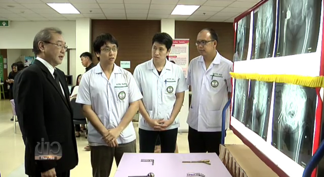 ไทยพบผู้สูงอายุป่วยเป็นโรคกระดูกพรุนเพิ่มขึ้น