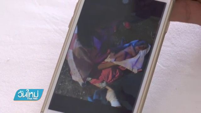 แห่ชื่นชมพยาบาลทำคลอดทั้งชุดนอน
