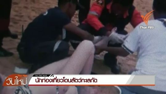 วิเคราะห์สัตว์ทะเลกัดนักท่องเที่ยวชาวออสซี่ "ฉลาม" หรือ"ปลาปักเป้า"