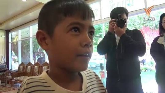 "น้องทาม" ยังไม่พร้อมใช้แขนเทียม
