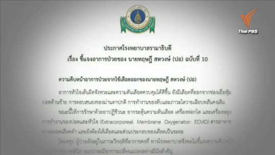 รพ.รามาฯแถลงอาการ "ปอ" ฉ.10 ยังวิกฤต กรมควบคุมโรคเผยไข้เลือดออกในกทม.ลด