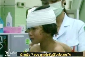 เด็กหญิง 7 ขวบ ถูกสุนัขร๊อตไวเลอร์กัดเจ็บสาหัส