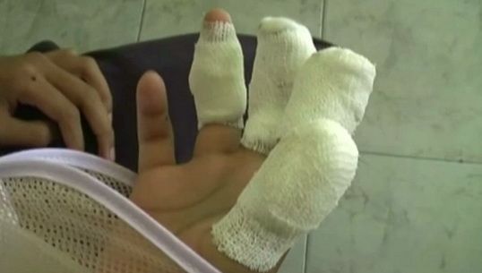 เกิดเหตุพลุไฟระเบิด วัยรุ่นอ่างทองบาดเจ็บนิ้วขาด