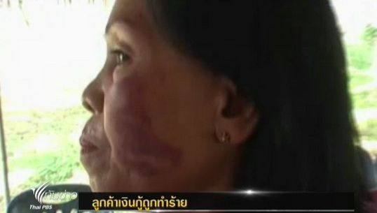 ชาวสระแก้วร้องสื่อมวลชนช่วยเหลือ หลังถูกแก๊งเงินกู้นอกระบบทำร้าย 
