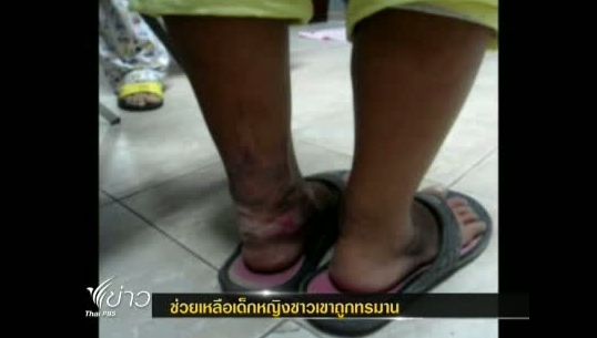 ตร.กำแพงเพชรช่วยเหลือเด็กหญิงชาวเขาถูกทรมานตั้งแต่อายุ 5 ปี