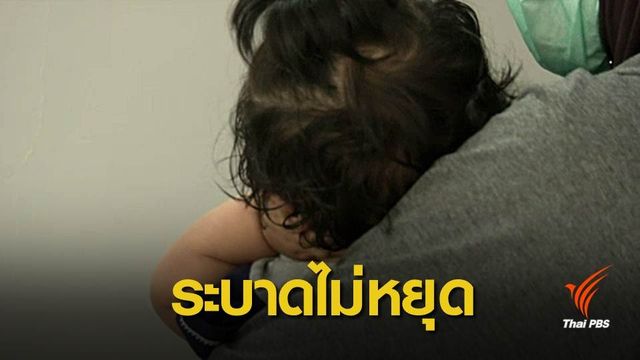 หัดระบาดทุกอำเภอในปัตตานี เสียชีวิต 10 ป่วยสะสมเกือบพันคน