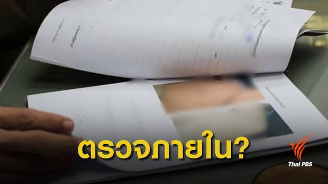 อ้างแค่ตรวจภายใน หรือ อนาจารคนไข้?