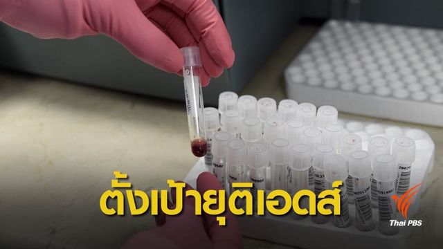 เผยสถิติติดเชื้อ HIV รายใหม่วันละ 15 คน แนะตรวจเลือดเร็ว รักษาเร็ว ยุติเอดส์