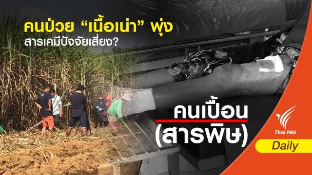 คนป่วย “เนื้อเน่า” พุ่ง สารเคมีปัจจัยเสี่ยง?