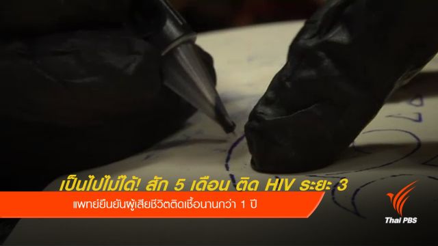แพทย์ ยืนยันหญิงเสียชีวิตติดเชื้อ HIV ก่อนสักลาย