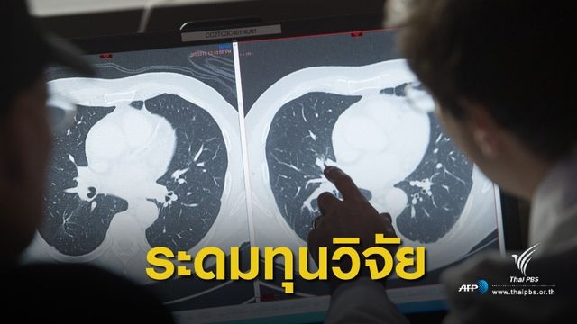 ระดมทุนวิจัย "ยารักษามะเร็ง" ลดค่ารักษา 2 แสนเหลือ 2 หมื่นบาท 