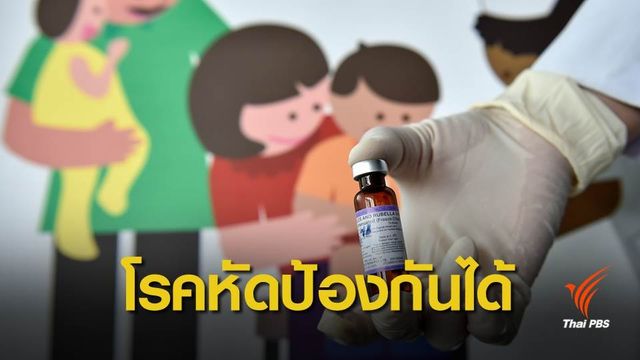 “โรคหัด” ติดต่อง่าย แต่ป้องกันได้ 