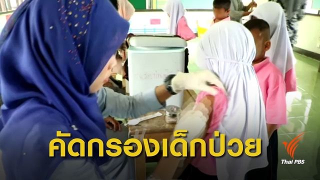 ยะลาคัดกรองเด็กป่วย ป้องกันโรคหัดแพร่ระบาดในโรงเรียน 