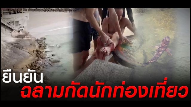 ยืนยันรอยแผลนักท่องเที่ยว ถูก "ฉลามหัวบาตร" งับ