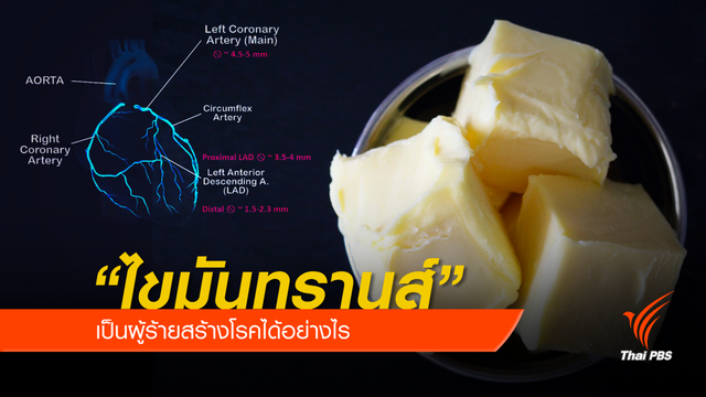 “ไขมันทรานส์” เป็นผู้ร้ายสร้างโรคได้อย่างไร