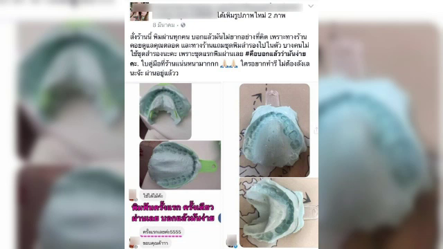 ทันตแพทย์เตือนใช้ "รีเทนเนอร์"เถื่อนเสี่ยงติดเชื้อในช่องปากถึงตาย