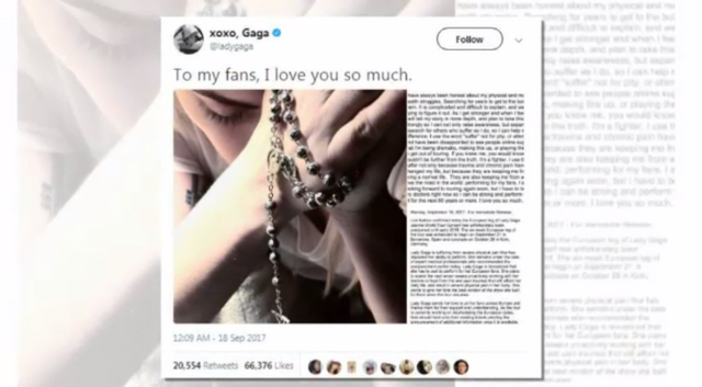 Lady Gaga ยกเลิกคอนเสิร์ตทั้งปีเพื่อรักษาตัว 