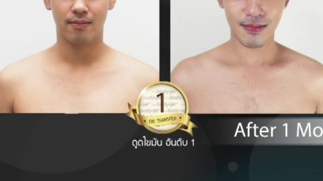 แรงจูงใจศัลยกรรม...เปลี่ยนชีวิต