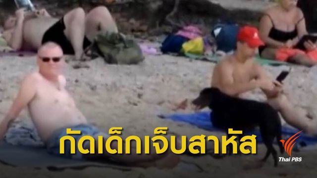 สุนัขรุมกัดเด็ก 5 ขวบเจ็บสาหัส หาดอ่าวนาง จ.กระบี่